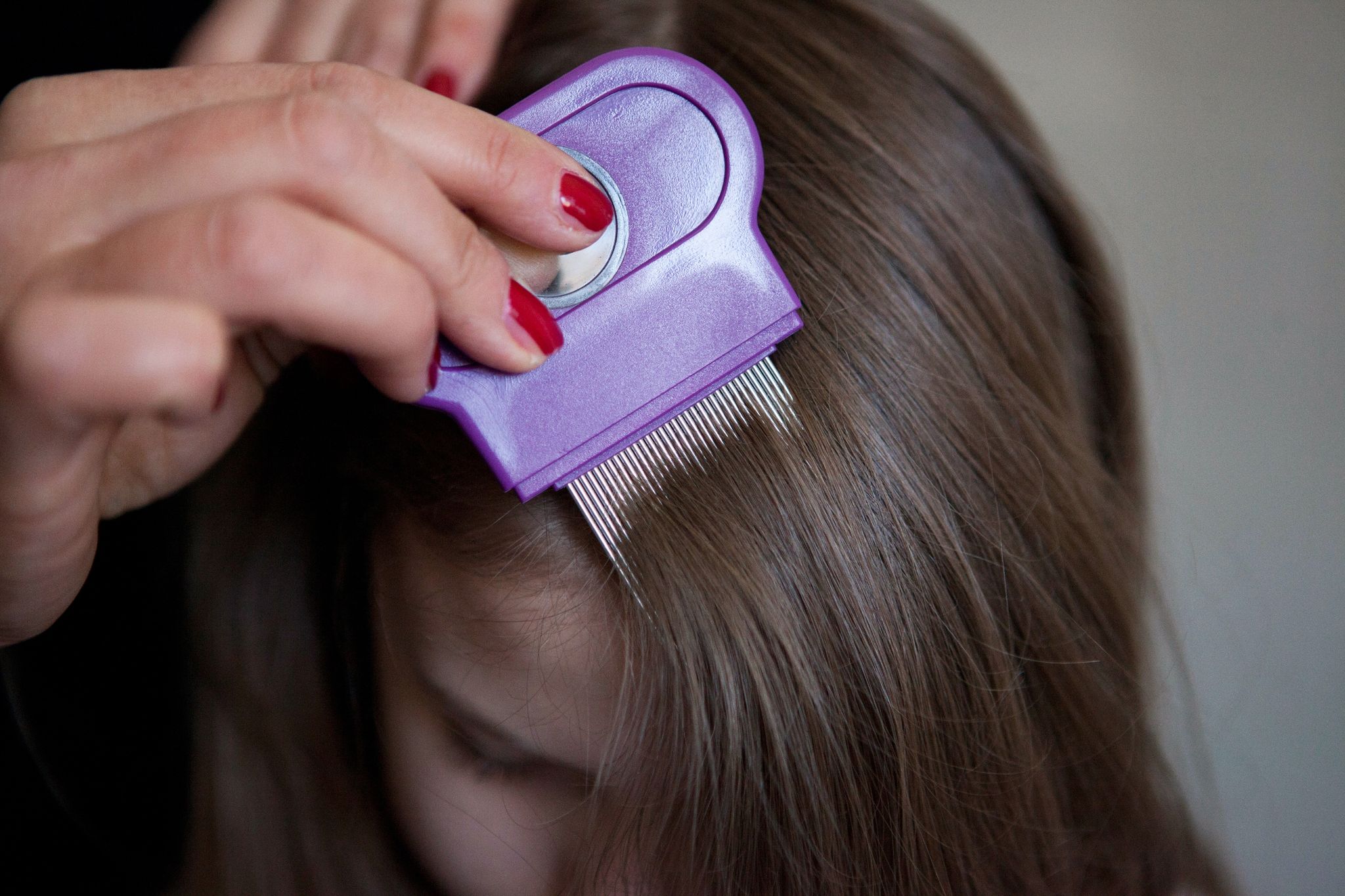 Lästig, aber ungefährlich: Kopfläuse wird man am besten mit Haarpflegespülung und einem Läusekamm los.