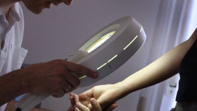 Bei der Hautkrebs-Früherkennung wird beim Dermatologen mit einem Vergrößerungsglas die Haut nach Veränderungen abgesucht.