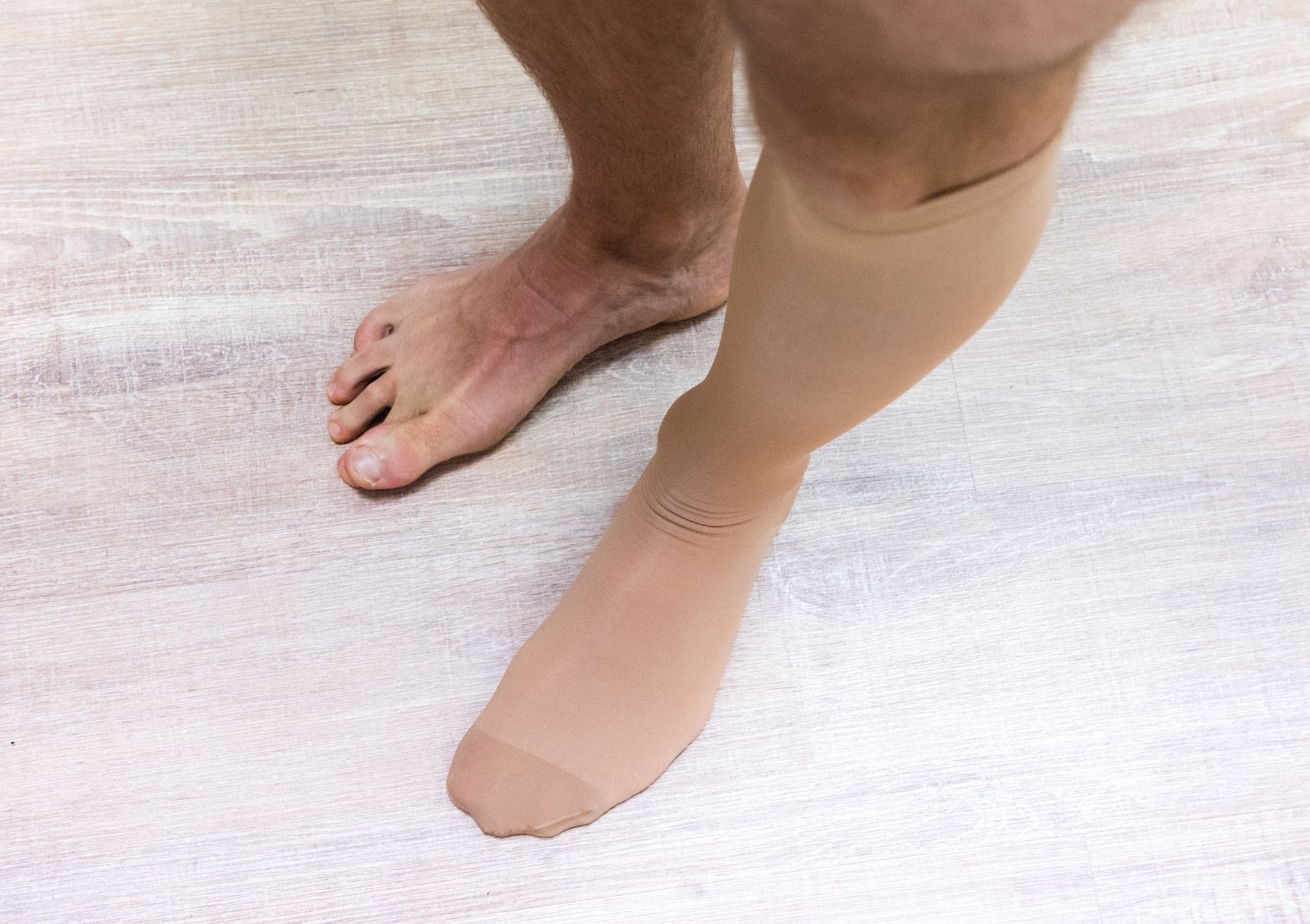 Thrombosestrümpfe üben Druck auf die Venen aus - dadurch verbessert sich der Blutfluss.