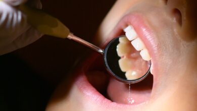 Fluoridlack soll die Zähne vor Karies schützen. Seit dem 24. April 2024 haben nun alle Kinder unter sechs Jahren unabhängig vom Kariesrisiko einen Anspruch auf diese Leistung.