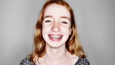 Zahnspange ist nicht gleich Zahnspange: Familien haben die Wahl zwischen der Kassen-Variante und einem Modell mit zahlreichen Extras.