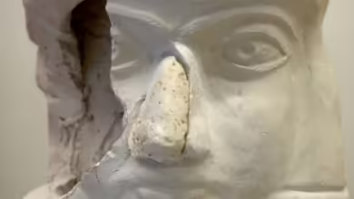 Es dröhnt, wummert, drückt im Kopf: Viele Menschen kennen Spannungskopfschmerzen.