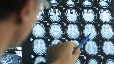 Arzt beurteilt gehirnquerschnitte einer schlaganfall patientin