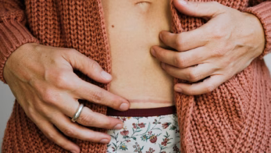 Eine frau berührt ihre kaiserschnittnarbe